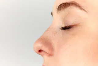 Rhinoplastie chirurgicale ou médicale ?