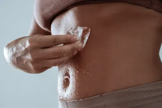 J’ai essayé… la cryolipolyse