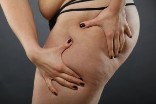 Endermologie : une technique anti-âge contre la cellulite