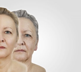 Plis d’amertume : acide hyaluronique et fils tenseurs pour redensifier et rehausser le bas du visage