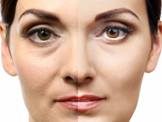 La médecine esthétique régénérative par injection de PRP