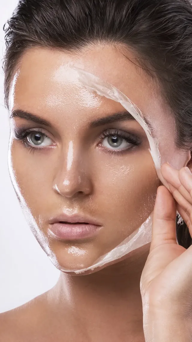 Le peeling Acnelan