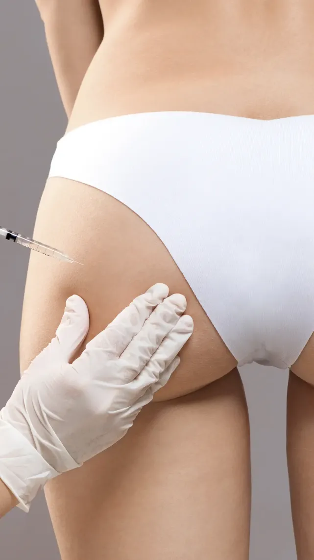Injections d’acide hyaluronique dans les fesses