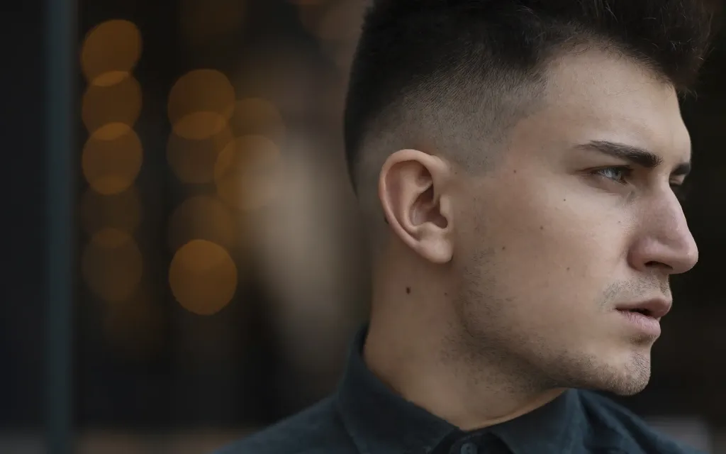 Rhinoplastie correction de la bosse nasale à Marseille