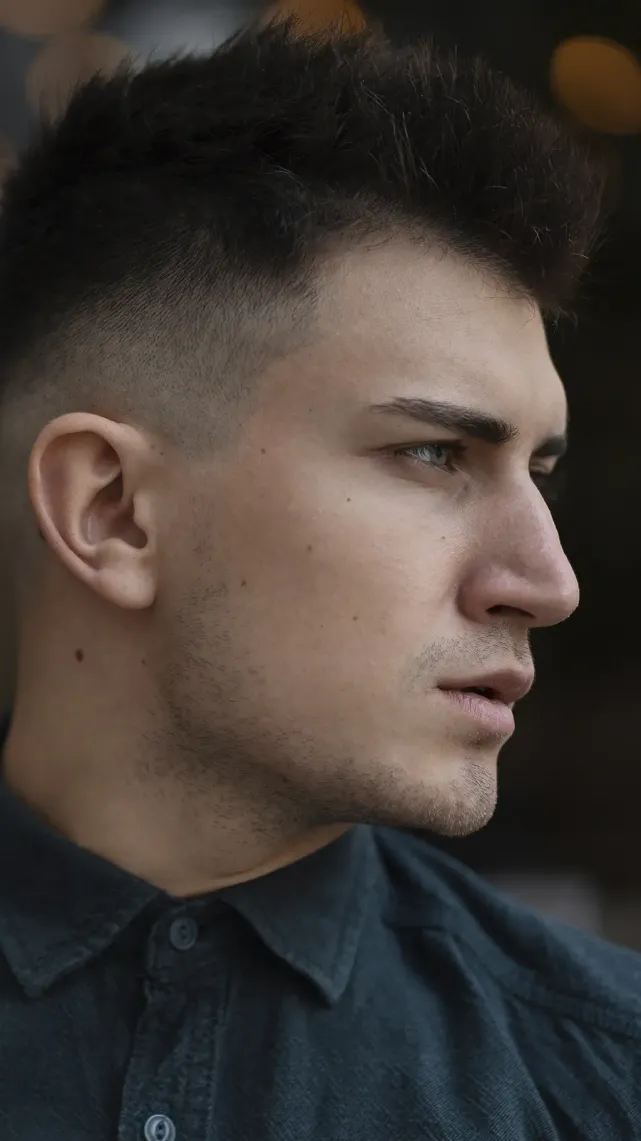 Rhinoplastie, correction de la bosse