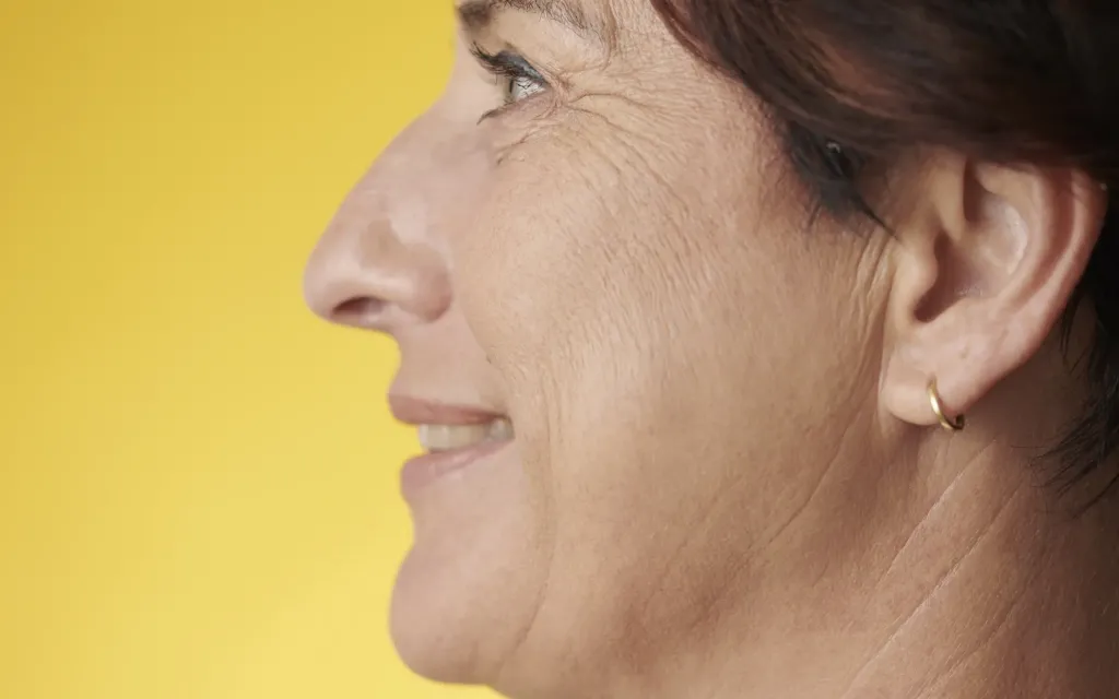 Rhinoplastie ultrasonique à Marseille
