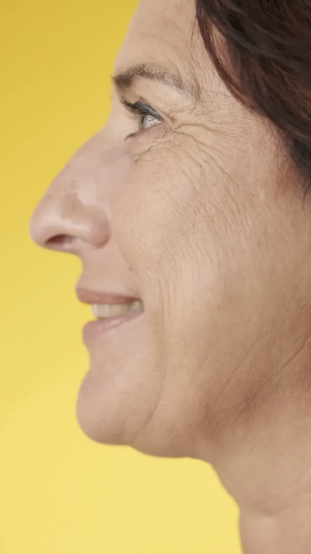 Rhinoplastie ultrasonique