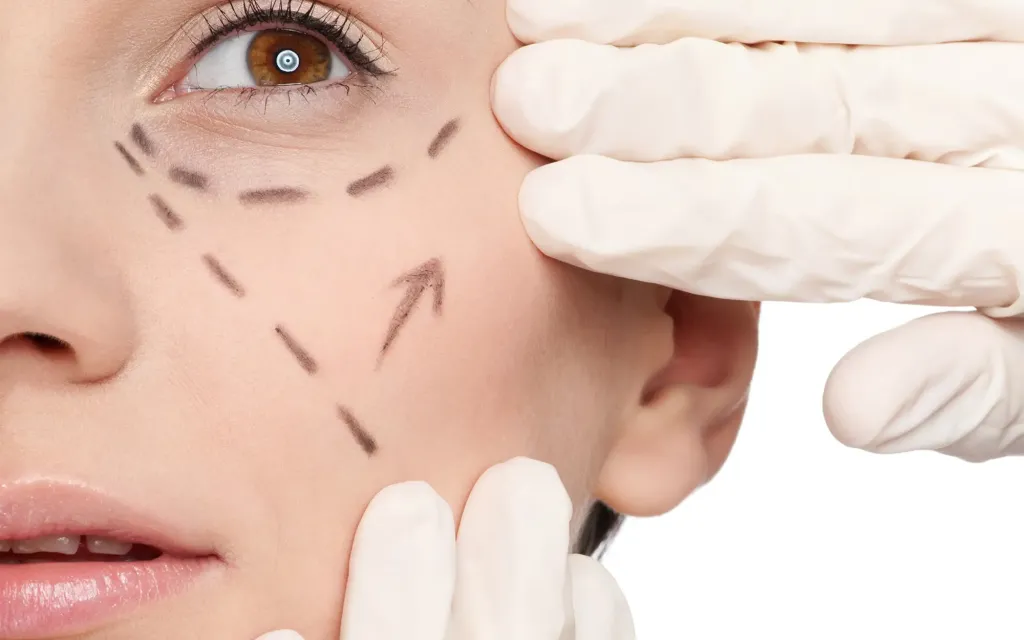 Le lifting cervico-facial à Marseille