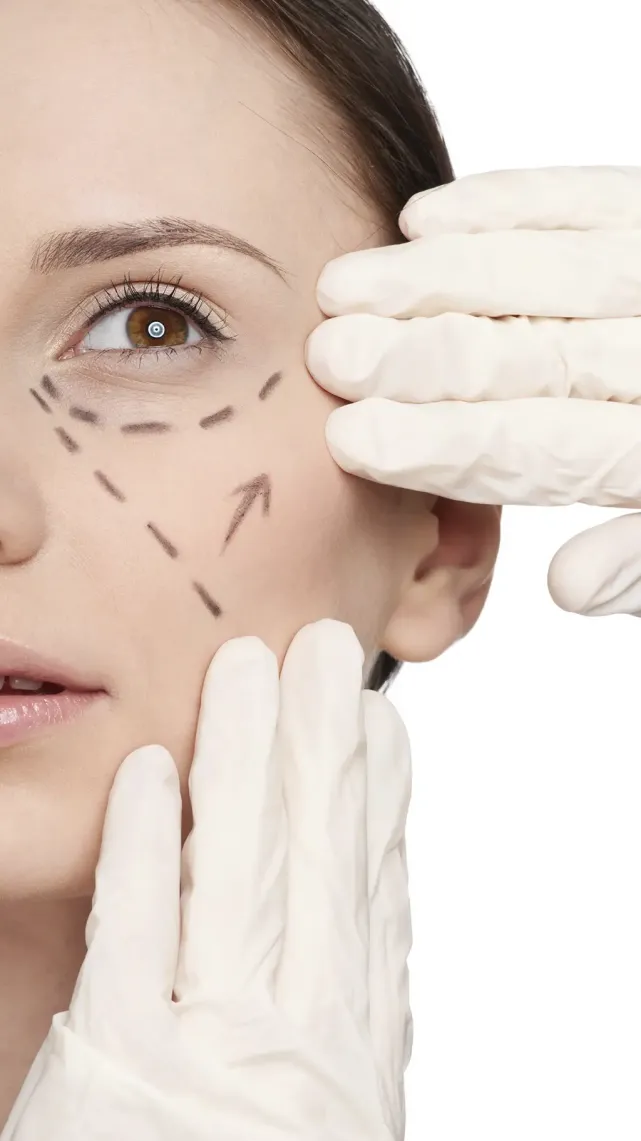 Lifting cervico-facial