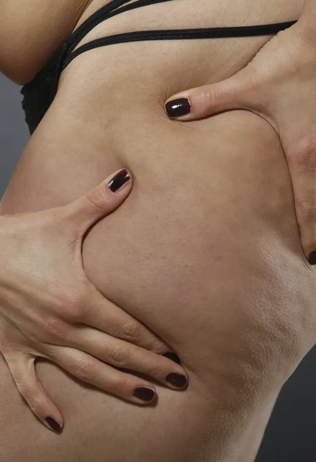 Introduction à la lipoaspiration