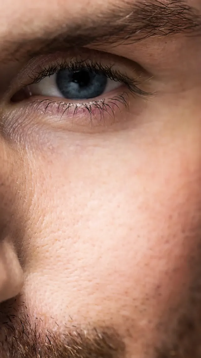 Blépharoplastie