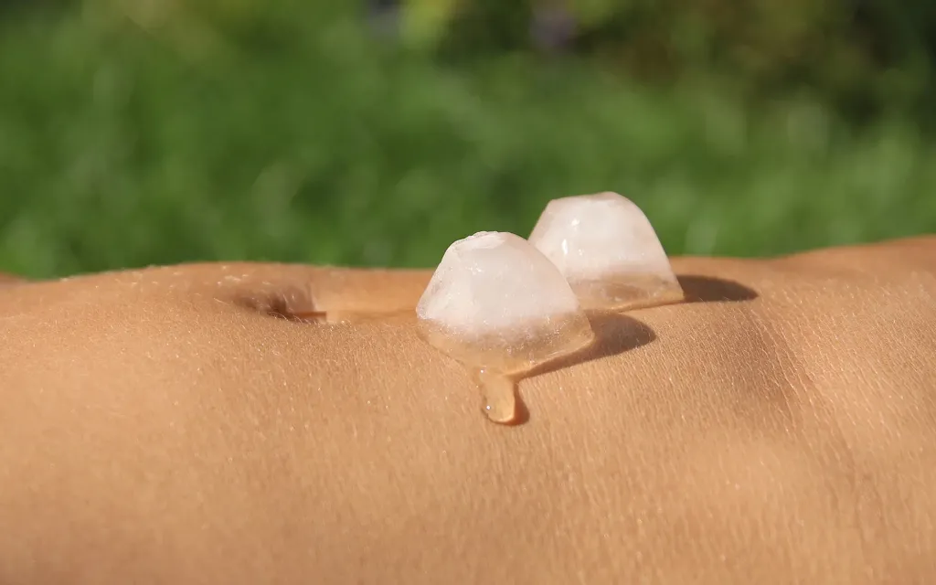 La cryolipolyse à Marseille