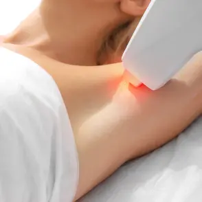 Epilation laser à Marseille